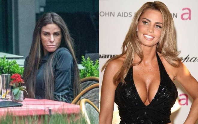 Model və müğənni üzünü dartdırdı 