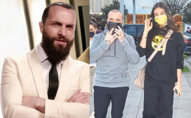 Müğənni saç əkdirdi