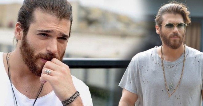 Aktyorun qolu çəkilişdə sındı - foto