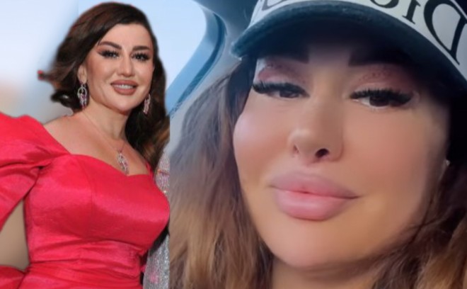 Fatimə burnunda dəyişiklik etdirib - foto